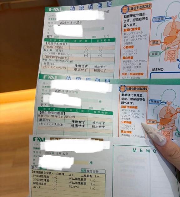 性病検査ちゃんとしてます