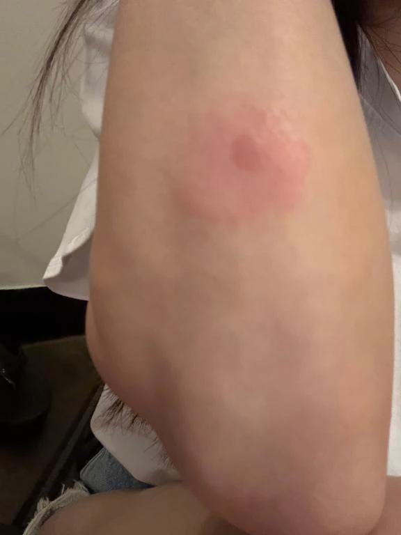 ほらな